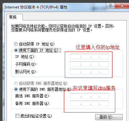 怎么设置电脑本地连接ip地址(4)