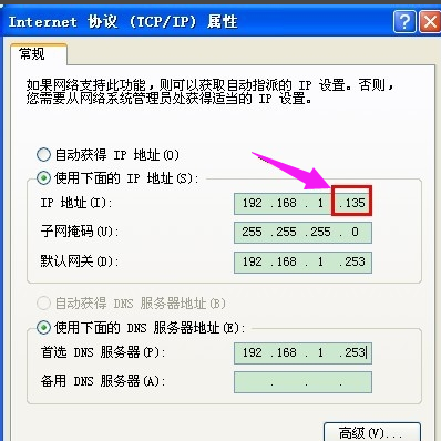 电脑本地连接受限制或无连接解决方法(11)